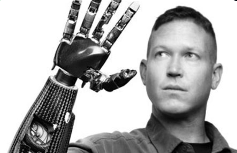 ProsthetiX volunteering project by dinesh talwadker